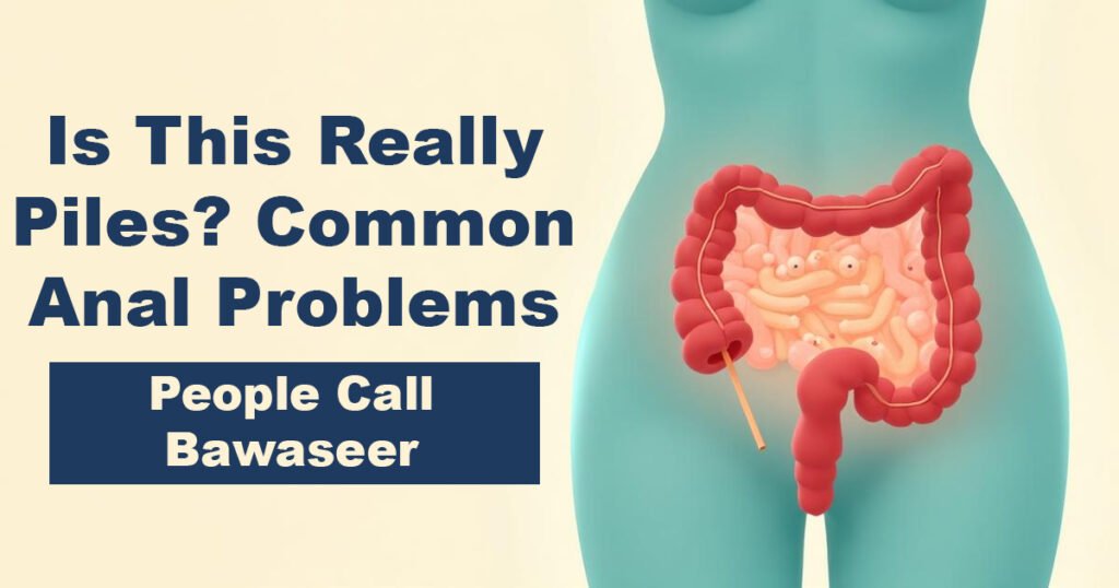 Is This Really Piles? Common Anal Problems People Call Bawaseer