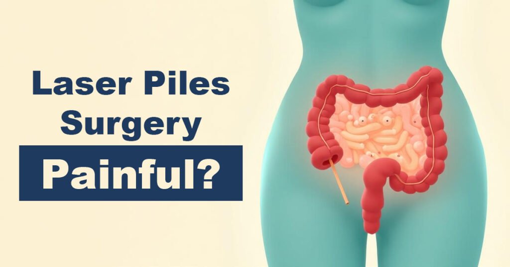 Is Laser Piles Surgery Painful?