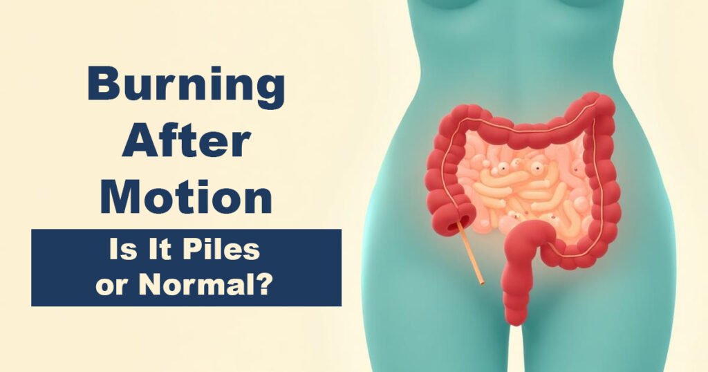 Burning After Motion – Is It Piles or Normal?
