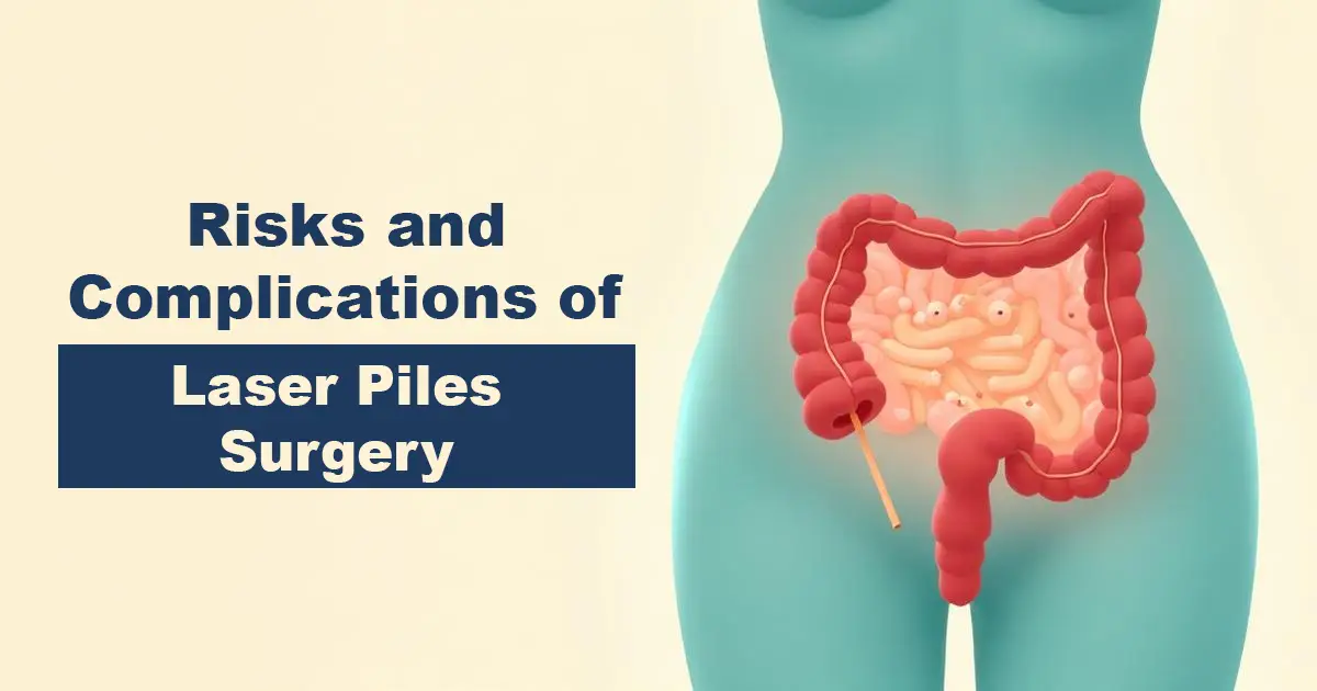 1Risks and Complications of Laser Piles Surgery - Karachi Piles Clinic laser piles surgery safety guide