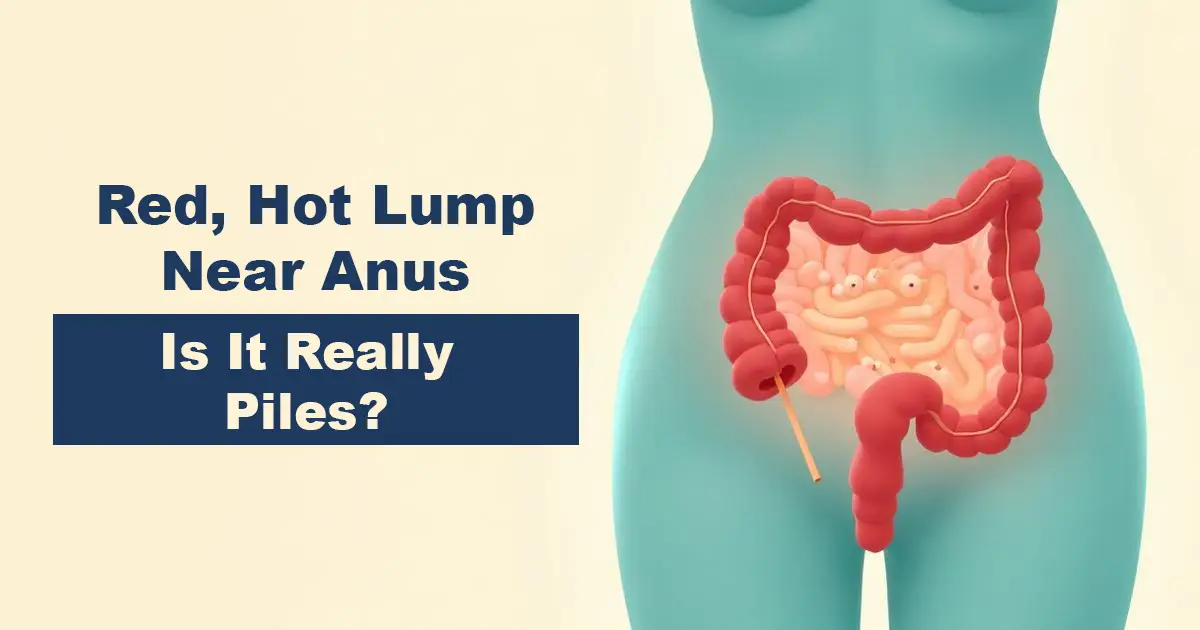 anal abscess specialist karachi red painful lump