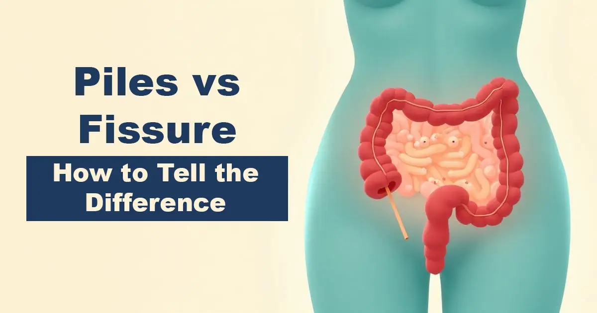 7 Piles vs Fissure – How to Tell the Difference - Karachi Piles Clinic anal fissure vs piles symptoms causes treatments karachi