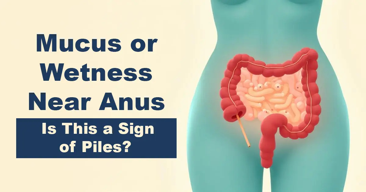 8 Mucus or Wetness Near Anus – Is This a Sign of Piles - Karachi Piles Clinic anal discharge treatment persistent rectal wetness