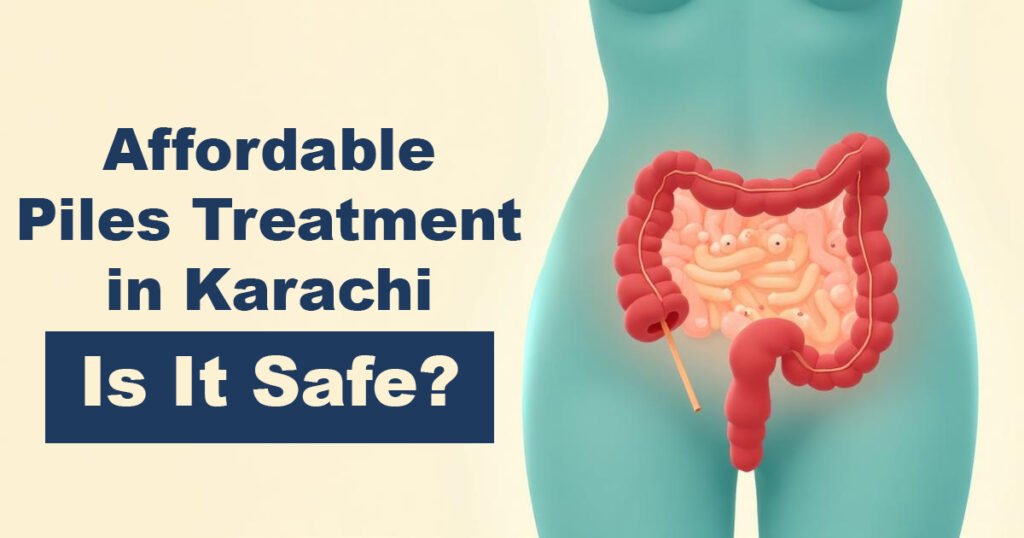 Affordable Piles Treatment in Karachi – Is It Safe?