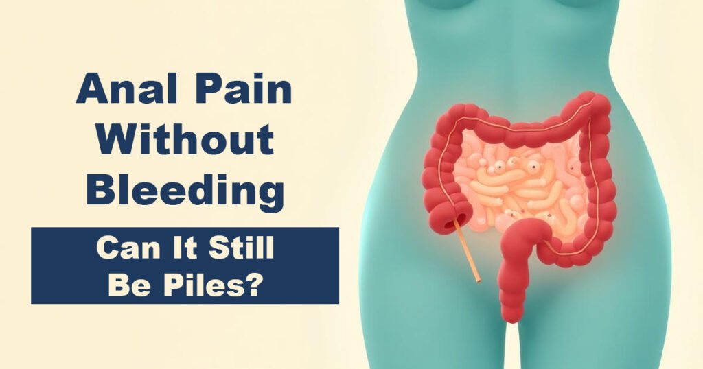 Anal Pain Without Bleeding – Can It Still Be Piles?
