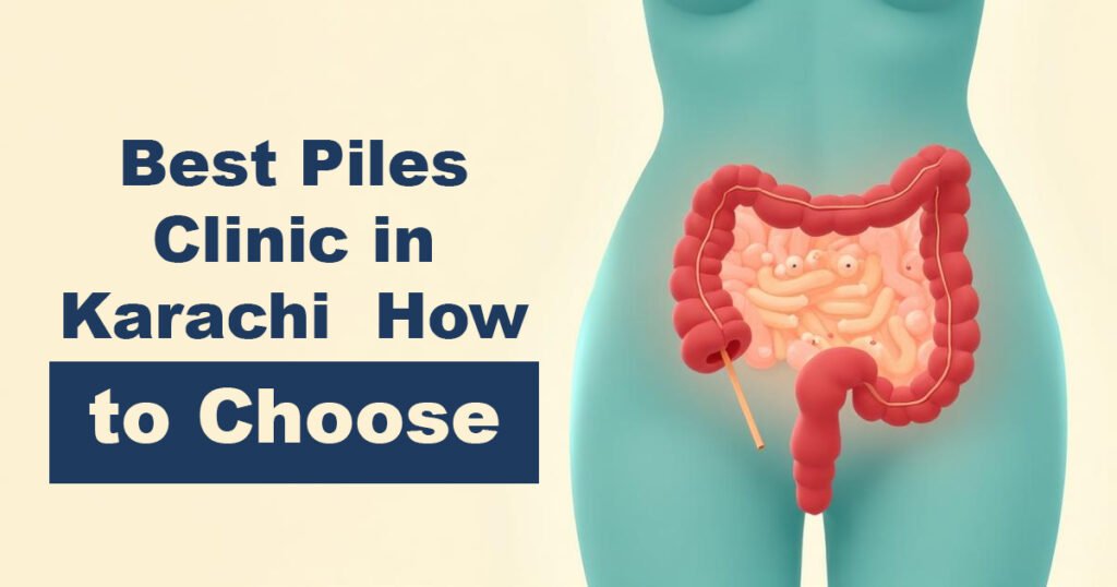 Best Piles Clinic in Karachi – How to Choose