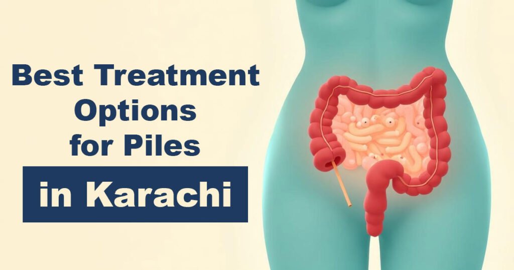 Best Treatment Options for Piles in Karachi - Karachi Piles Clinic Best Treatment Options for Piles in Karachi