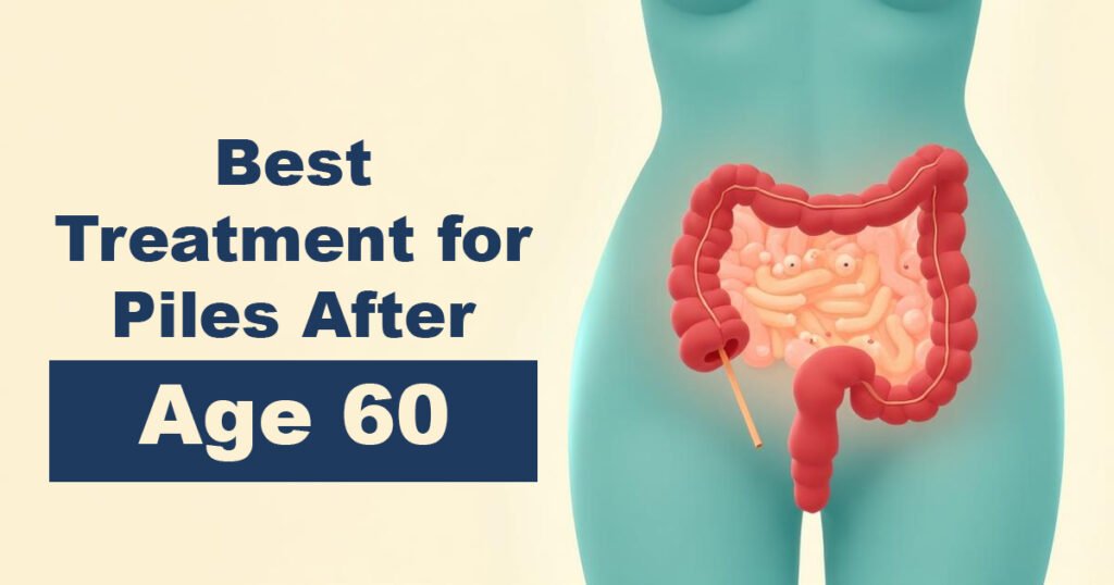 Best Treatment for Piles After Age 60