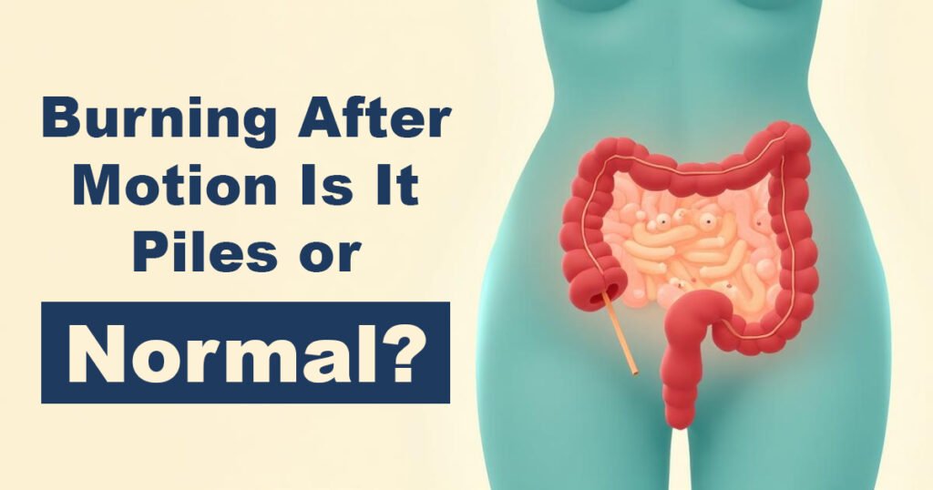 Burning After Motion – Is It Piles or Normal?