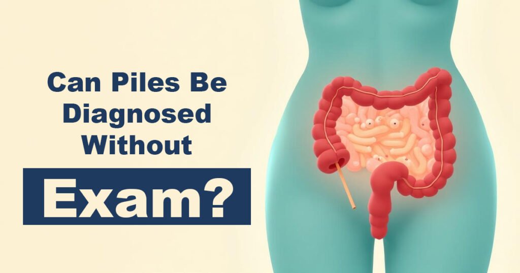 Can Piles Be Diagnosed Without Exam?