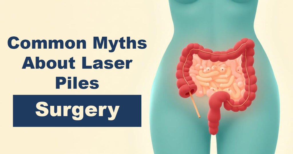 Common Myths About Laser Piles Surgery