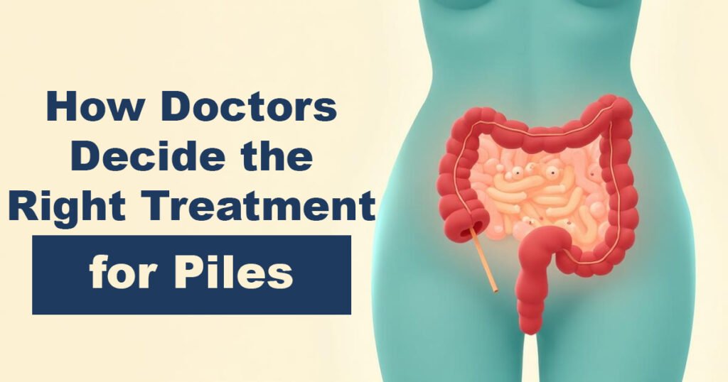 How Doctors Decide the Right Treatment for Piles