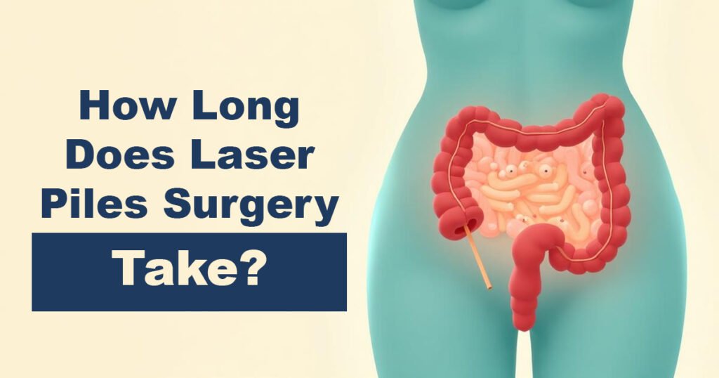 How Long Does Laser Piles Surgery Take?
