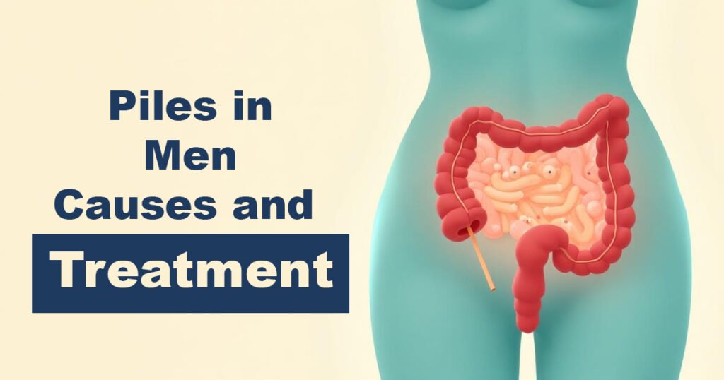 How to Choose the Right Doctor for Piles in Karachi - Karachi Piles Clinic How to Choose the Right Doctor for Piles in Karachi