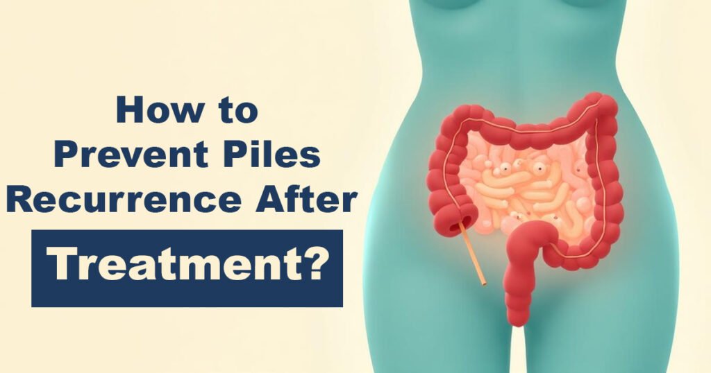 How to Prevent Piles Recurrence After Treatment
