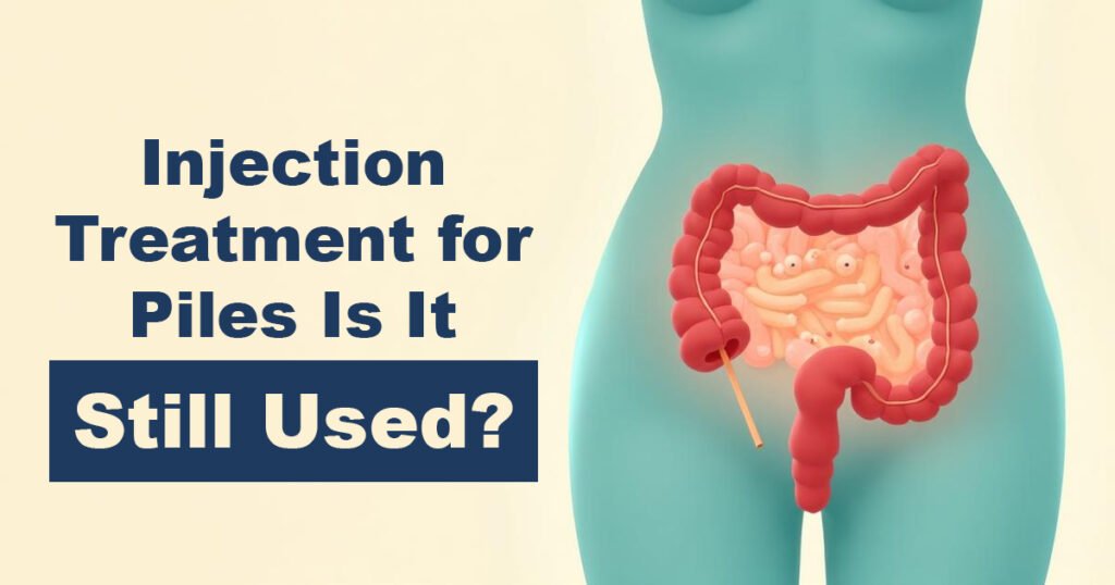 Injection Treatment for Piles – Is It Still Used?