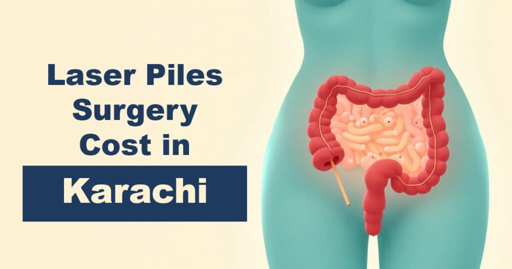 Laser Piles Surgery Cost in Karachi