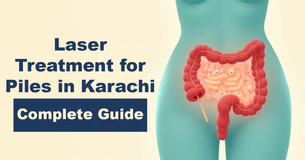 Laser Treatment for Piles in Karachi – Complete Guide