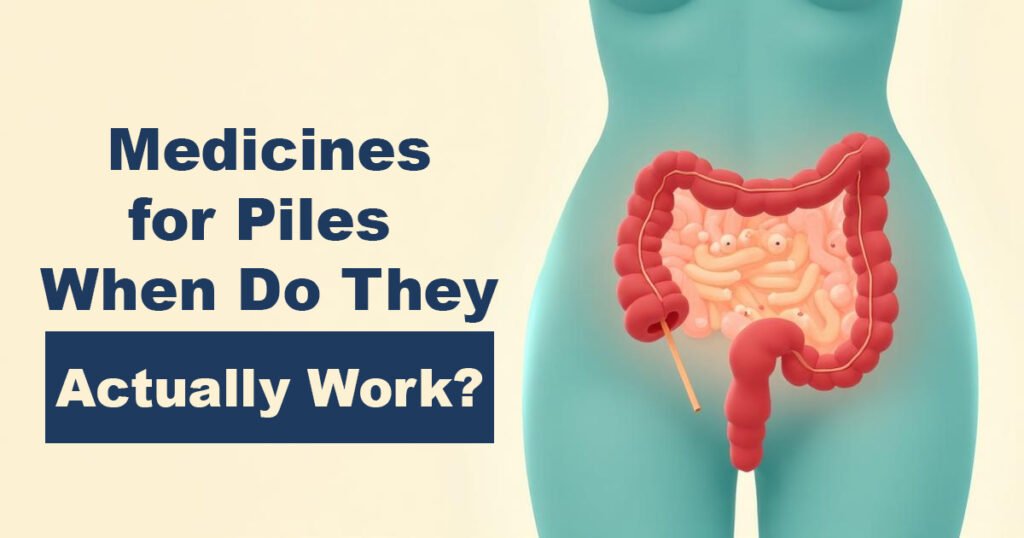 Medicines for Piles – When Do They Actually Work?