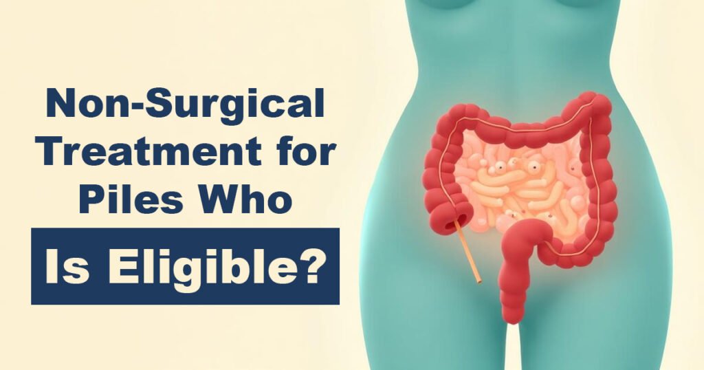 Non-Surgical Treatment for Piles – Who Is Eligible?