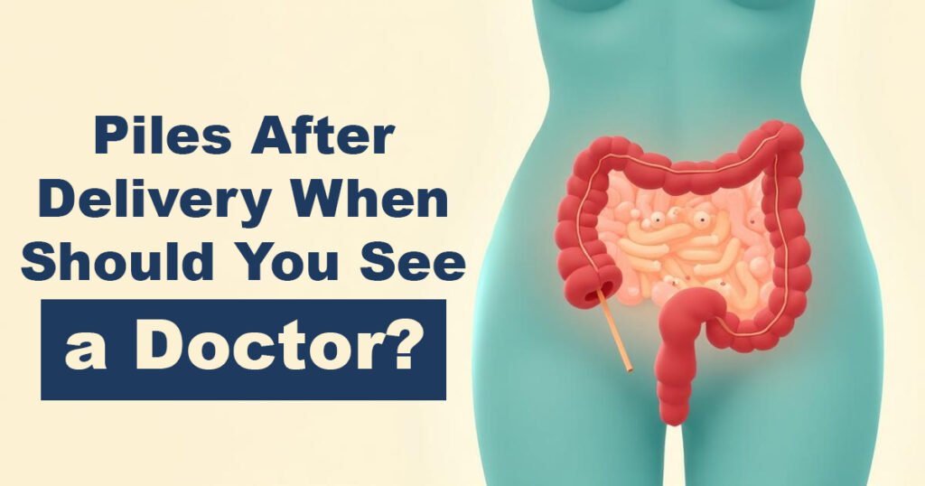 Piles After Delivery – When Should You See a Doctor?