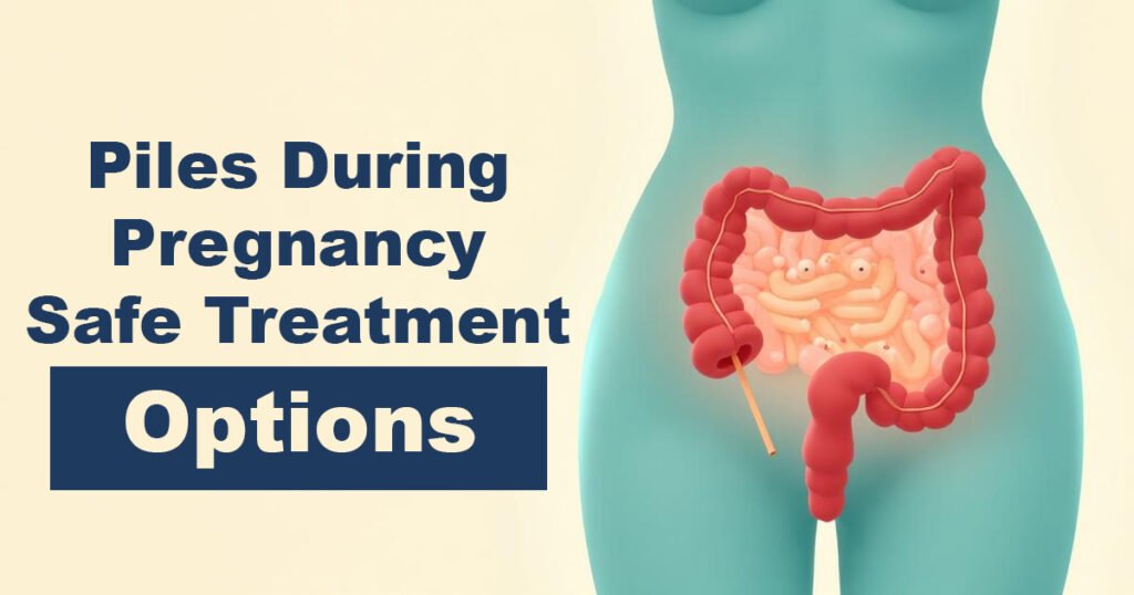 Piles During Pregnancy – Safe Treatment Options