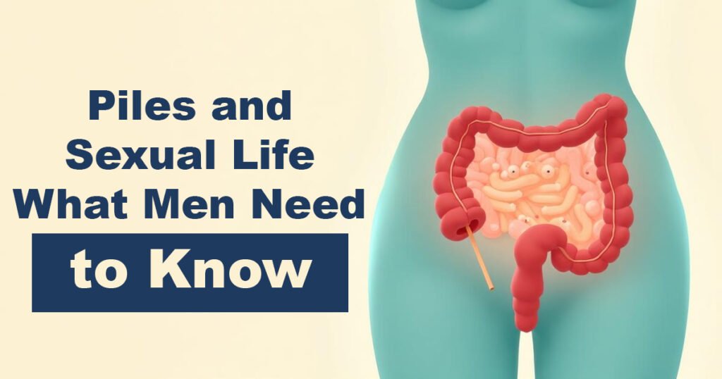 Piles and Sexual Life – What Men Need to Know