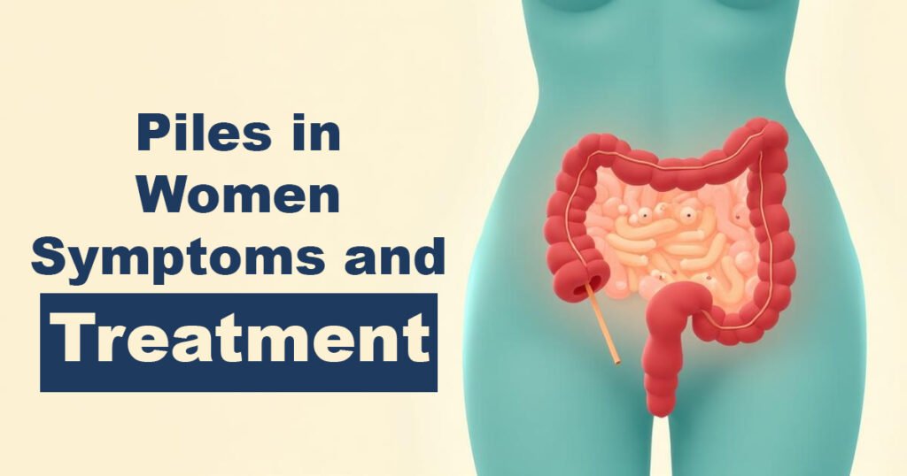Piles in Women – Symptoms and Treatment
