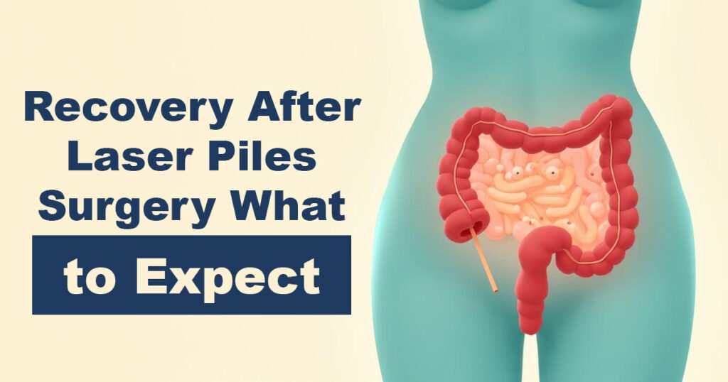 Recovery After Laser Piles Surgery – What to Expect