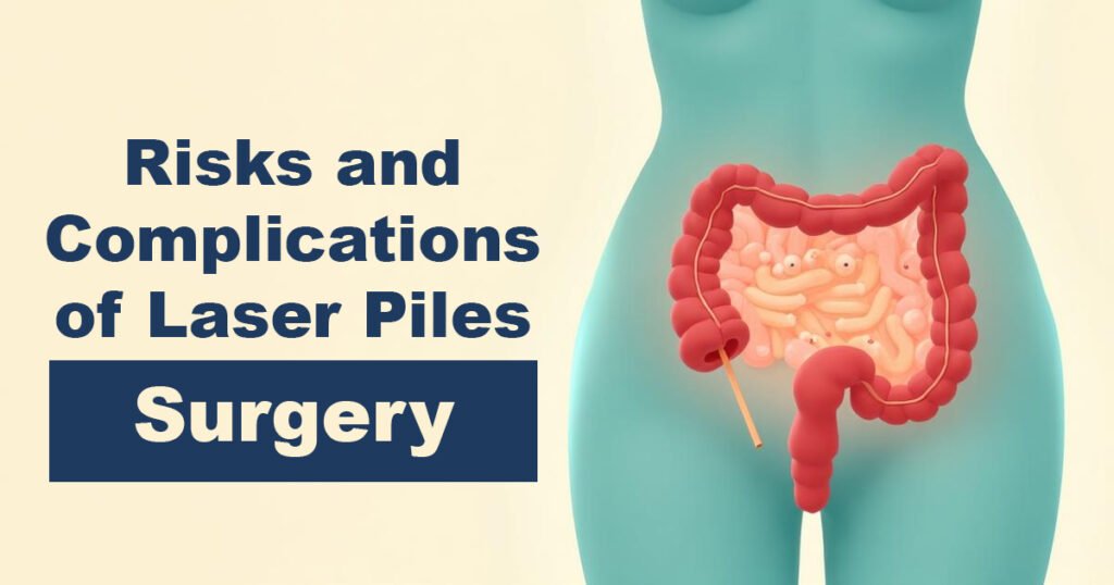 Risks and Complications of Laser Piles Surgery - Karachi Piles Clinic Risks and Complications of Laser Piles Surgery