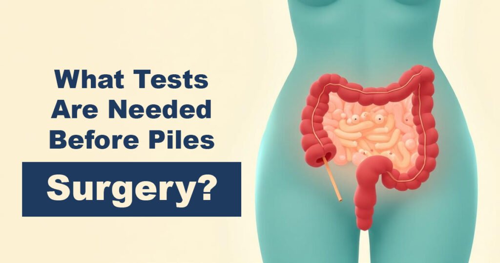 What Tests Are Needed Before Piles Surgery - Karachi Piles Clinic What Tests Are Needed Before Piles Surgery?