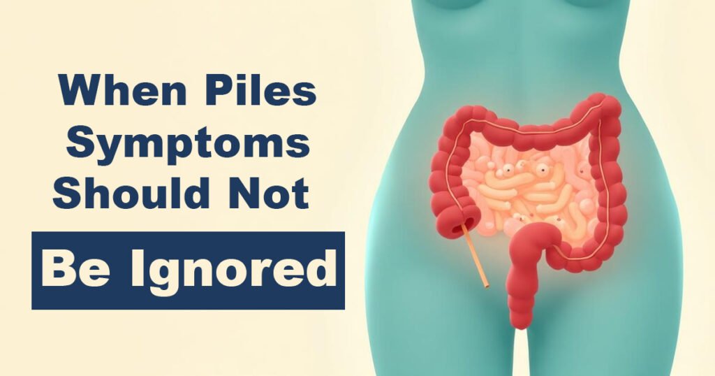 When Piles Symptoms Should Not Be Ignored