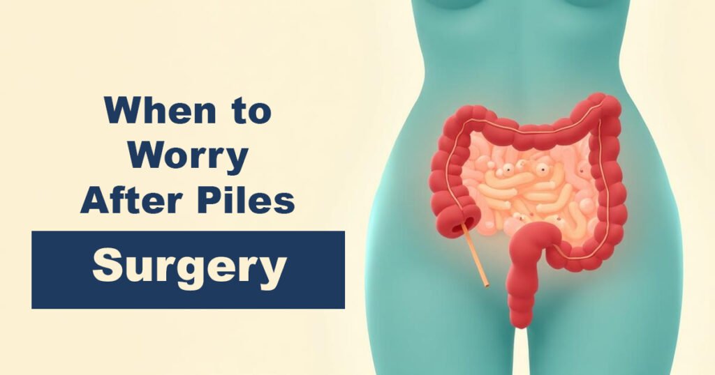 When to Worry After Piles Surgery