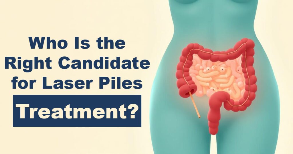 Who Is the Right Candidate for Laser Piles Treatment - Karachi Piles Clinic Who Is the Right Candidate for Laser Piles Treatment?