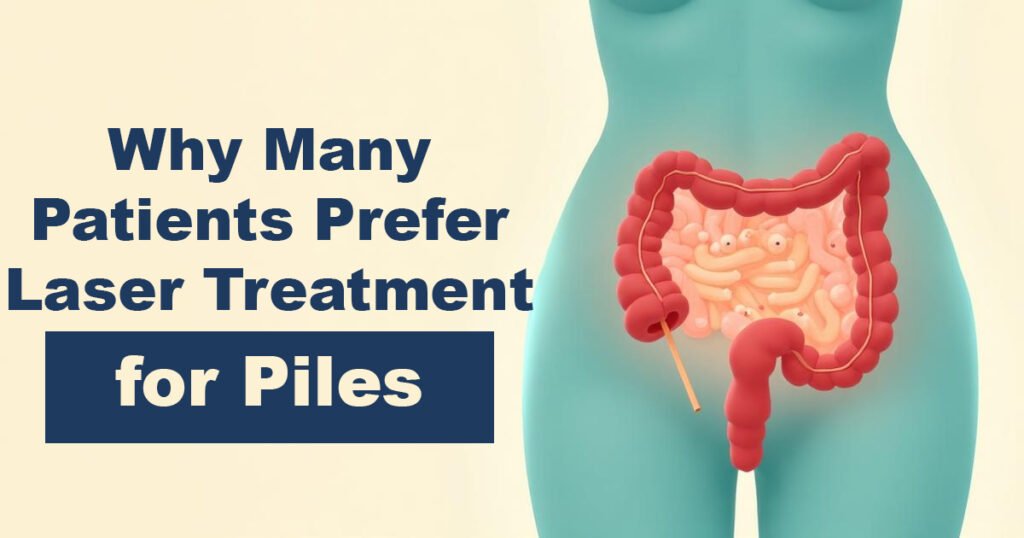 Why Many Patients Prefer Laser Treatment for Piles